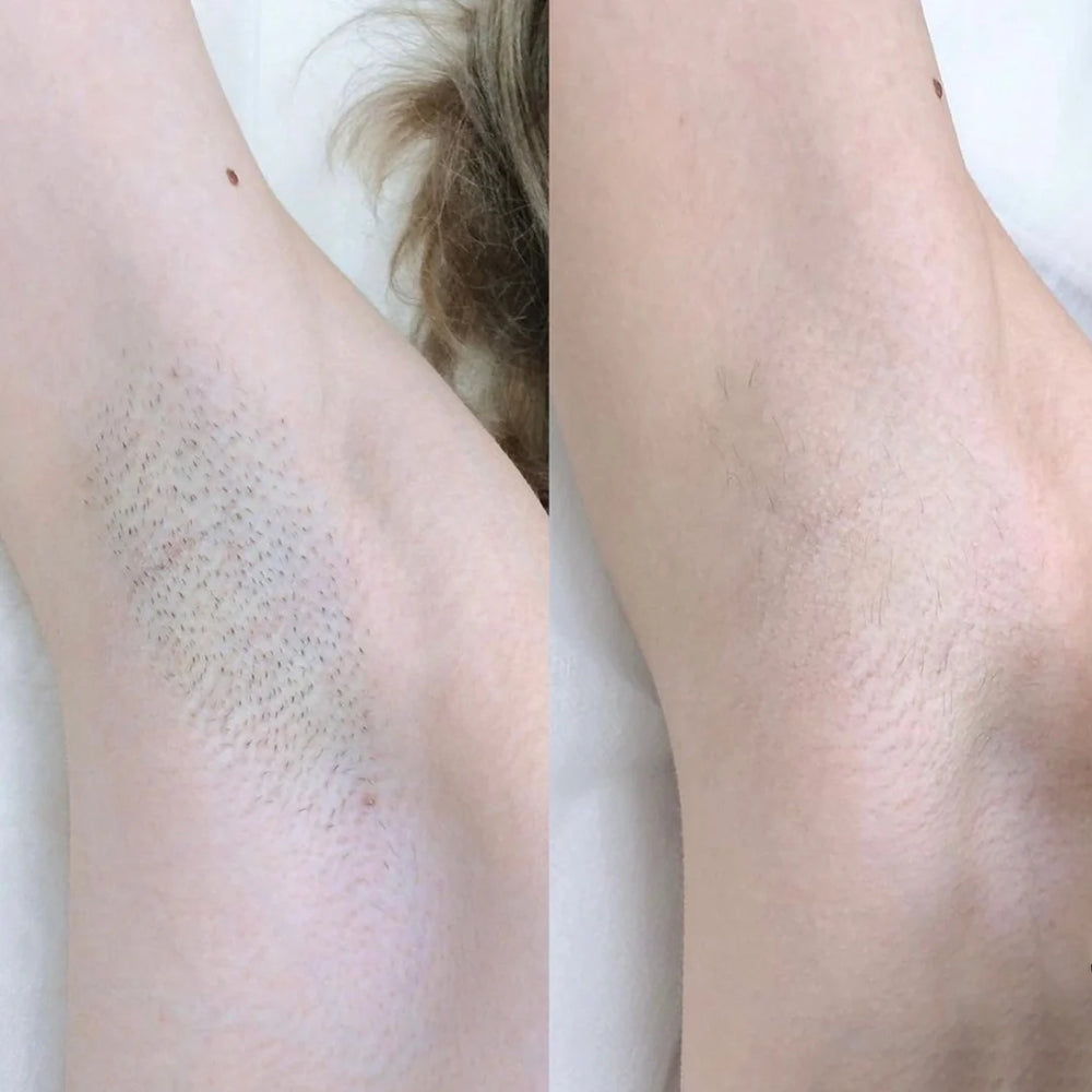 <h2>No Hype, Just Results!</h2><h3>Loved By 59,000+ Ladies!</h3>
