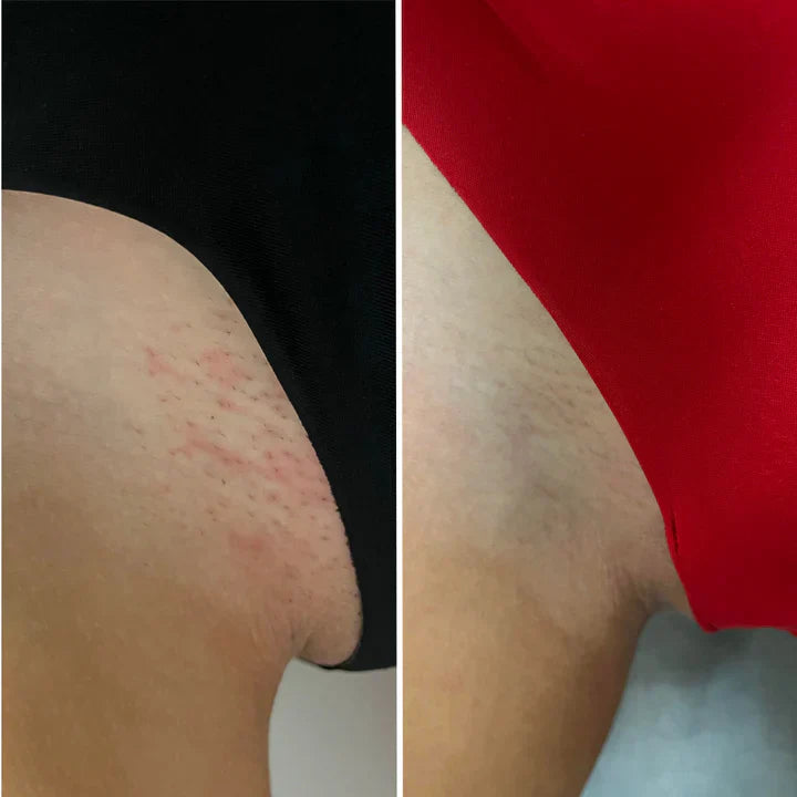 <h2>No Hype, Just Results!</h2><h3>Loved By 59,000+ Ladies!</h3>