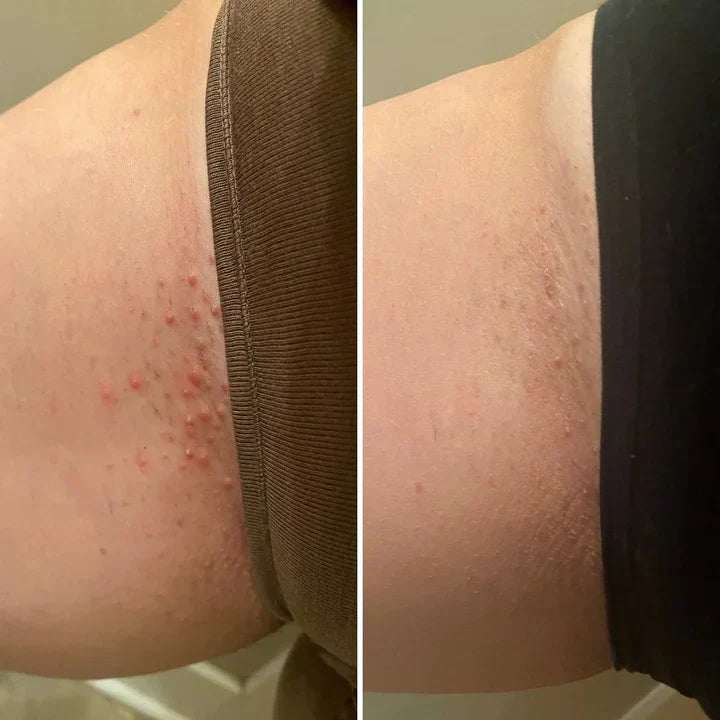 <h2>No Hype, Just Results!</h2><h3>Loved By 59,000+ Ladies!</h3>